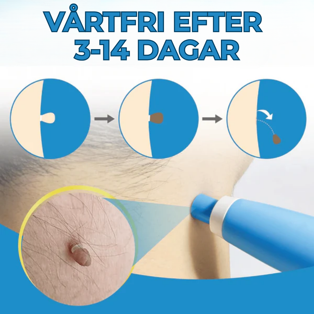 WartStop™ |Säg adjö till hudflikar – utan operation och utan ärr!