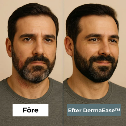 DermaEase™ | Naturlig lindring för kliande, röd och känslig hud
