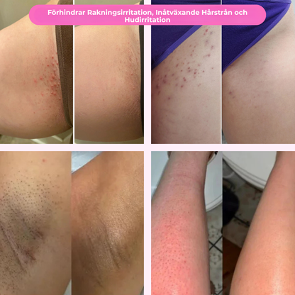 SmoothSkin™ | Är rakning en mardröm? Inte längre — möt rakhyveln som förändrar allt