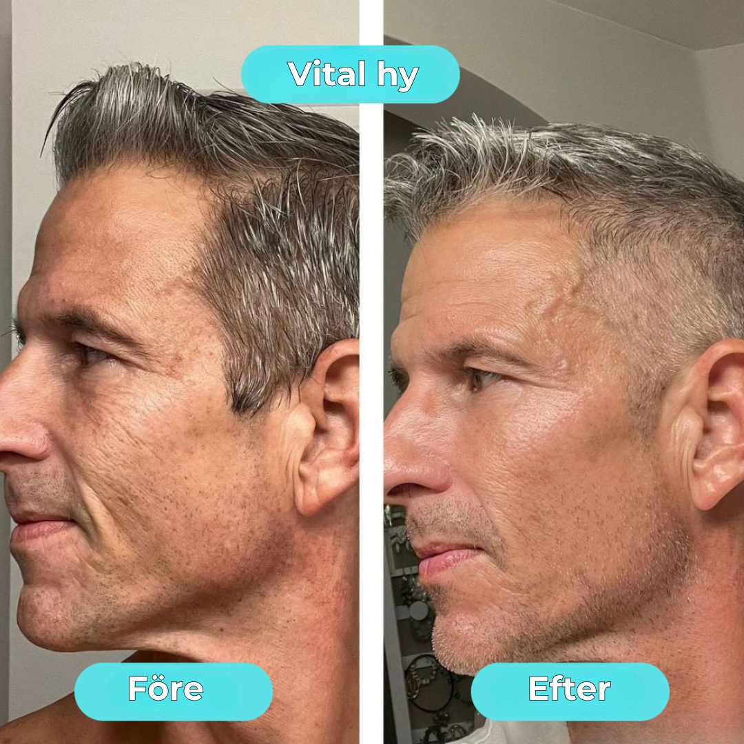 FrostyFace™ | Den virala Ice Glow för din morgonrutin