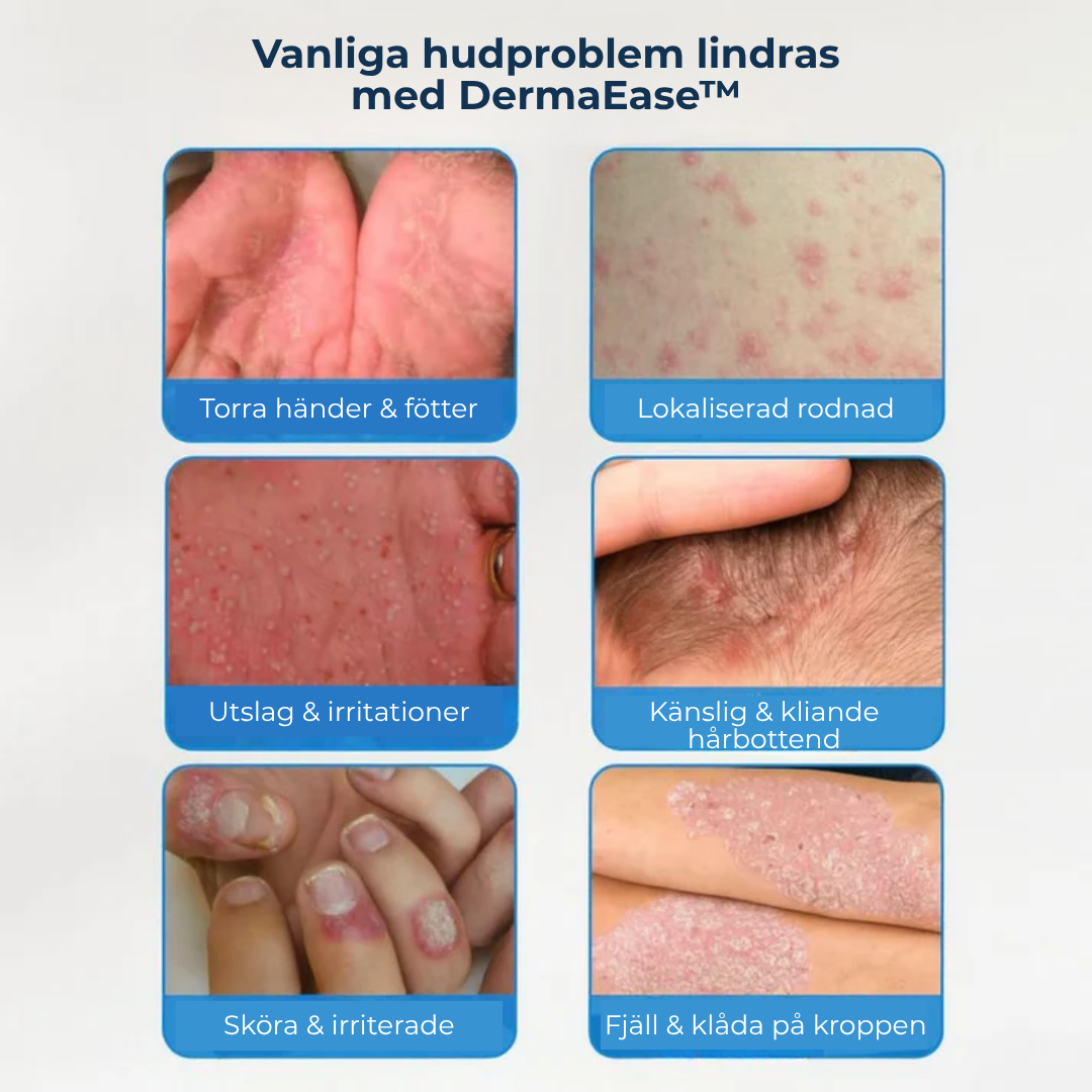 DermaEase™ | Naturlig lindring för kliande, röd och känslig hud