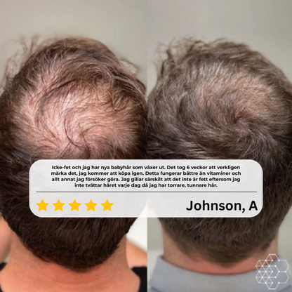 Follexa™ Hair Roll-On System | Återupptäck Ditt Hår – Fylligare, Starkare och Mer Livskraftigt!