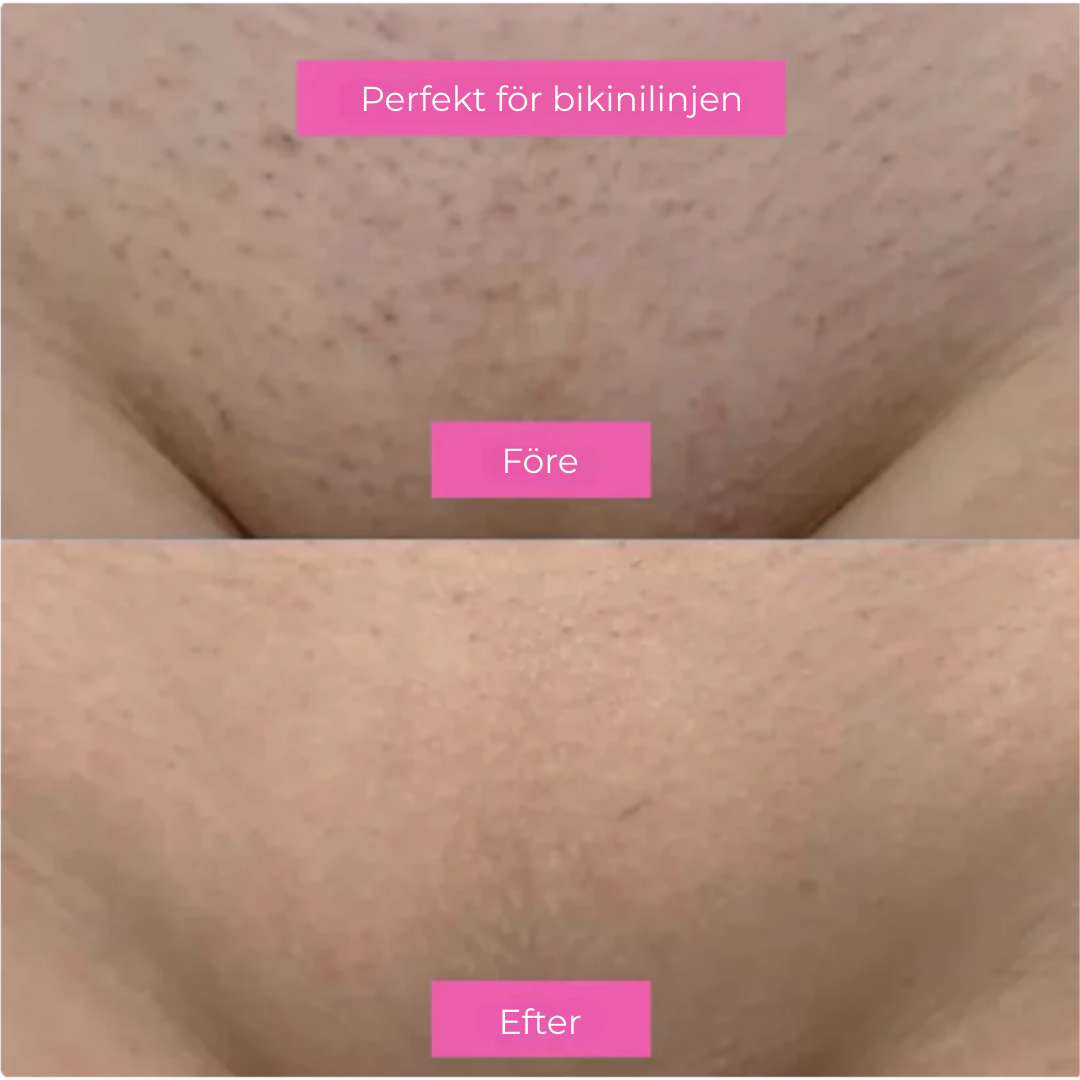 BareBloom™ | Len hud, långsammare hårväxt – din nya vardagsfavorit!