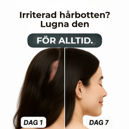 DermaEase™ | Naturlig lindring för kliande, röd och känslig hud