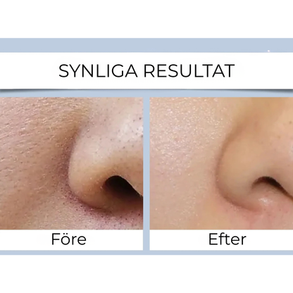 PurePulse™ | Djuprengöring & Pormaskborttagare