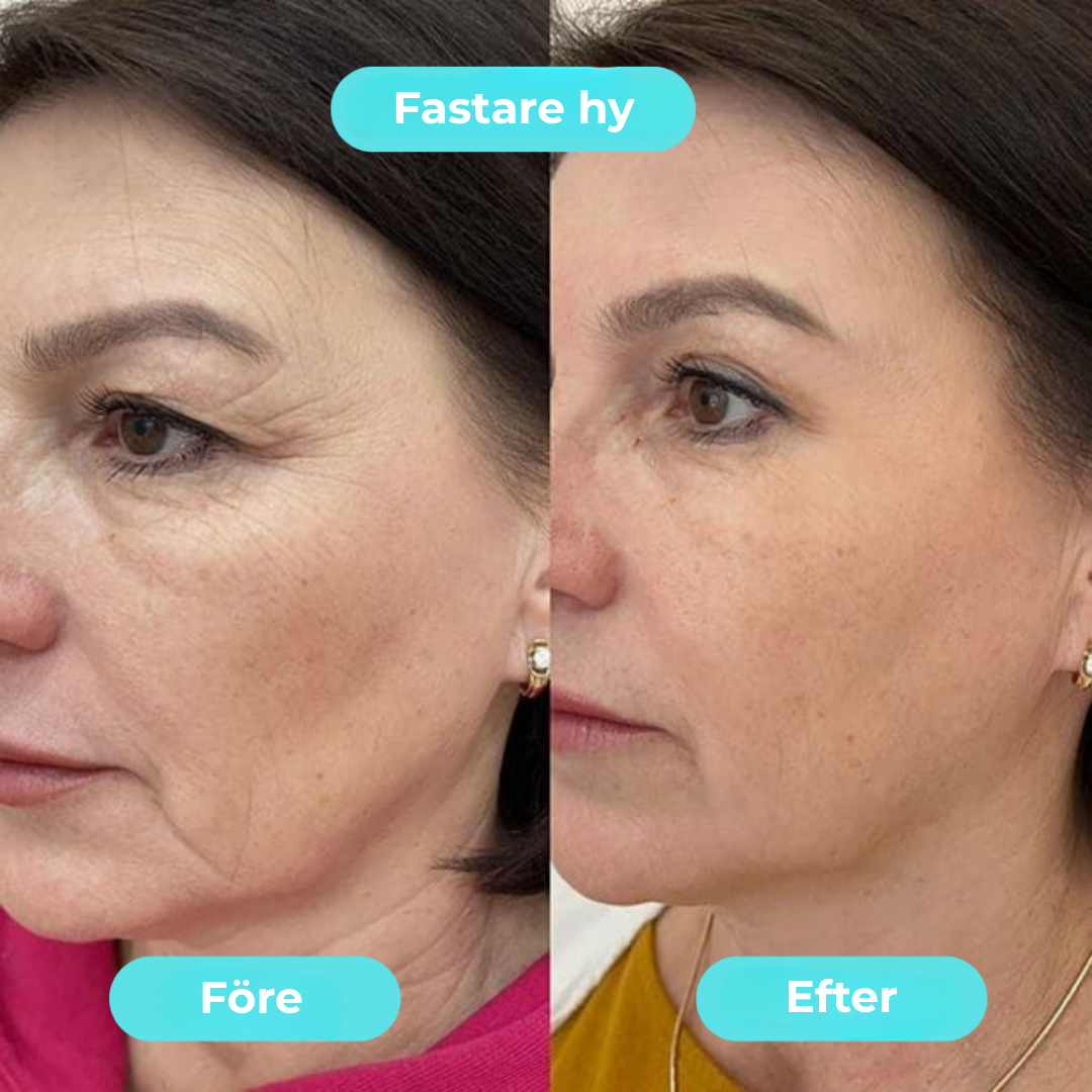 FrostyFace™ | Den virala Ice Glow för din morgonrutin