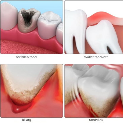 DentaRelief™ | Lindra smärta och irritation på några minuter – naturligt och säkert