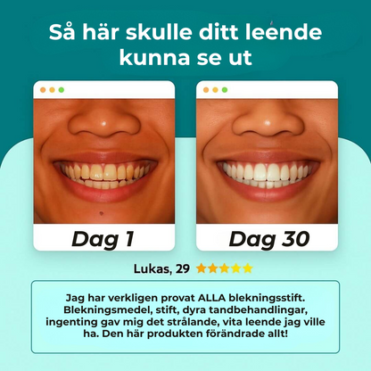Lunadent™ | Revolution inom tandborstning – Rena tänder, utan ansträngning