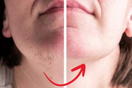 HairEase™ | Mjuk, hårfri hud utan stubb – direkt från roten